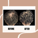 REVIVV® for Him Hair Growth Serum